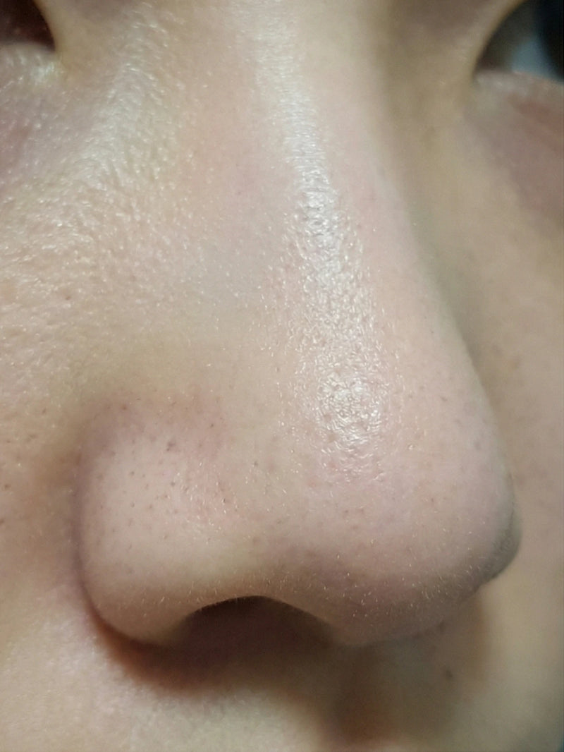 After